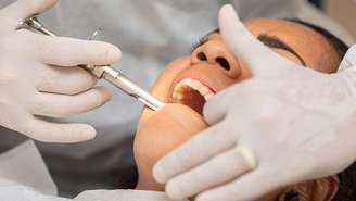 Saiba tudo sobre o implante dentário