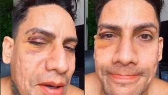 Arquiteto é xingado e agredido no carnaval de Olinda