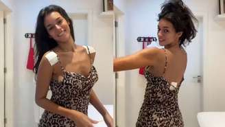 Alane Dias mostra machucados após uso de costeiro —