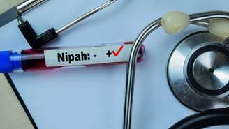 Vírus Nipah – depositphotos.com / olanstock