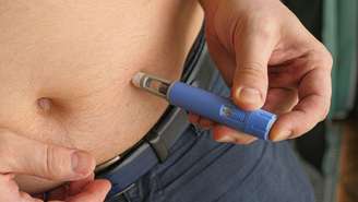 Foto: Reprodução/Shutterstock