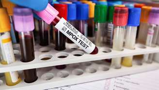 A prioridade em evitar o avanço do Mpox se explica pelo potencial de disseminação em ambientes urbanos densamente povoados e pela possibilidade de atingir grupos mais vulneráveis, como pessoas imunossuprimidas, gestantes e crianças pequenas – depositphotos.com / angellodeco