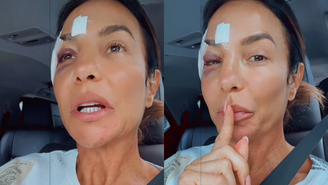 Ivete Sangalo comemora alta hospitalar após desmaio e brinca: 'Maquiagem diferente'