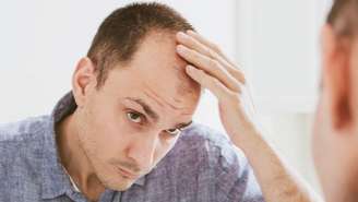 Transplante capilar pode ser feito no verão