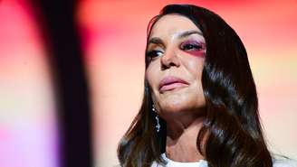 Ivete Sangalo fez show no Ginásio do Ibirapuera após sofrer acidente doméstico e ficar com olho roxo