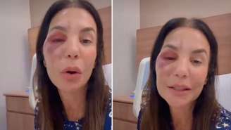 Ivete Sangalo (Reprodução/Instagram)