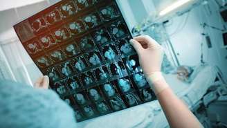 O tratamento do aneurisma é definido de forma individualizada, considerando localização, tamanho, formato, idade do paciente e presença de outras doenças – depositphotos.com / sudok1