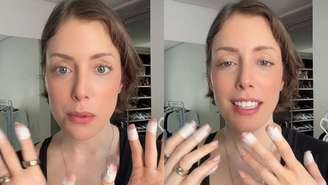 Fabiana Justus revela diagnóstico de dermatilomania