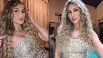 Confira o que é neuralgia do trigêmeo, doença da Lívia Andrade