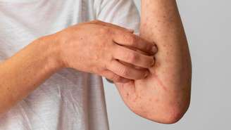 Fotos: Divulgação/Freepik