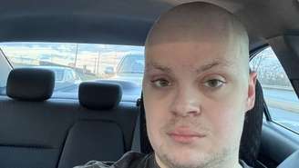 Torcedor do Baltimore Ravens posta foto com a cabeça raspada