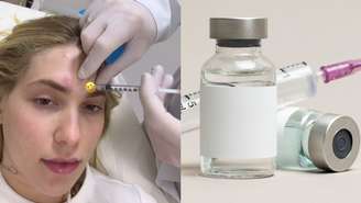 Virginia Fonseca recorre a Botox para controle de enxaqueca