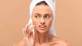 Pele sob controle: como genética, hormônios e bactérias influenciam a acne -depositphotos.com / IgorVetushko