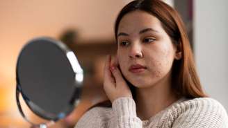 Entenda como o volta às aulas pode piorar a acne