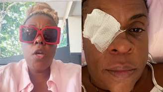 Atriz diz que voltou a enxergar, mas ainda enfrenta sensibilidade à luz durante tratamento