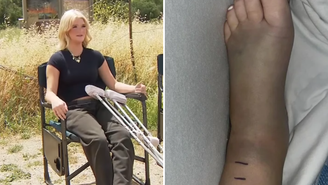 Adolescente fica em estado grave após ser picada por cascavel durante passeio de bicicleta