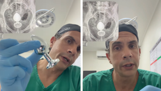 Daniel Brosco explica riscos de ficar com plug anal preso