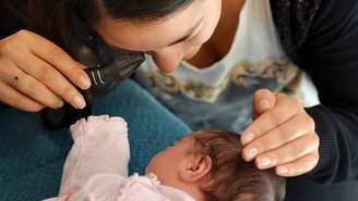 O Teste do Olhinho, ou teste do reflexo vermelho, é um exame simples, rápido e indolor que se faz ainda na maternidade ou nas primeiras semanas de vida – depositphotos.com / lucidwaters