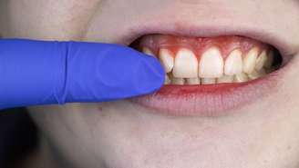 saliva_depositphotos.com / Alena1919