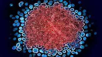 Registro de uma transmissão colorizada de numerosas partículas do vírus HIV replicando