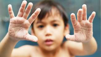 Como “pneus de chuva”, os dedos enrugados ajudam a segurar melhor superfícies escorregadias – depositphotos.com / wckiw