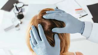 caspa – depositphotos.com / AndrewLozovyi