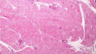 Gordura marrom: o ‘motor térmico’ do corpo humano em ação – depositphotos.com / jlcalvo@ucm.es