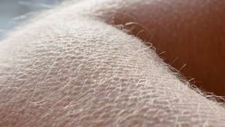 Na superfície, o arrepio se manifesta como pequenos relevos na pele, o popular “pele de galinha”. Por trás desse desenho estão células especializadas, fibras musculares minúsculas e circuitos nervosos automáticos – depositphotos.com / Tunatura