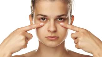 Do ponto de vista médico, fala-se em três grandes grupos de olheiras: pigmentares, vasculares e estruturais – depositphotos.com / VGeorgiev