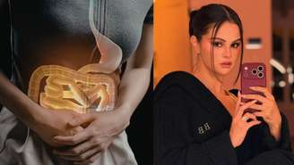 Entenda o que é SIBO, condição intestinal citada por Selena Gomez, seus sintomas, causas e como é feito o diagnóstico e tratamento