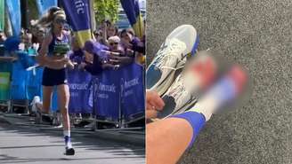 Atleta termina corrida com pés sangrando, em Londres