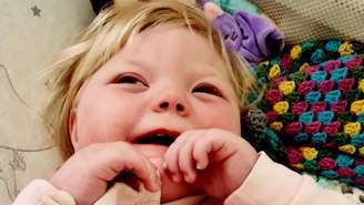 Menina britânica de 2 anos é a única no mundo com combinação genética rara e enfrenta convulsões e atrasos no desenvolvimento