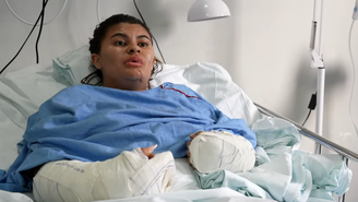 Ana Clara teve as mãos decepadas pelo ex-cunhado