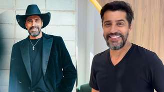 Veja como ficou o sorriso do Cowboy