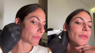 Mari Gonzalez faz procedimento para fechar orelha rasgada