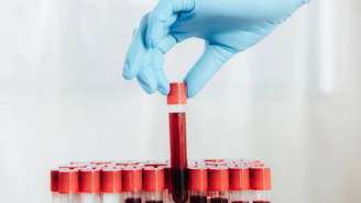 Biomarcadores ligados à inflamação, hormônios do estresse e atividade genética já mostram resultados promissores em estudos recentes – depositphotos.com / MicEnin