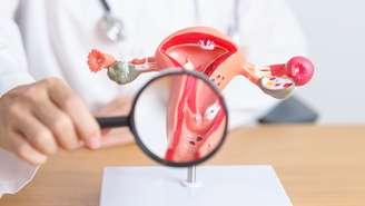 Nem todo mioma uterino exige cirurgia; em muitos casos, o acompanhamento médico é suficiente