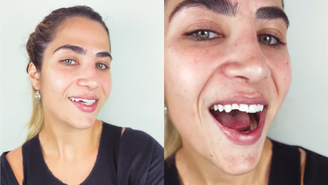 Jéssica Beatriz quebra dois dentes em tombo