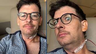Moshe Kasher recebeu o diagnóstico após encontrar um caroço na garganta 