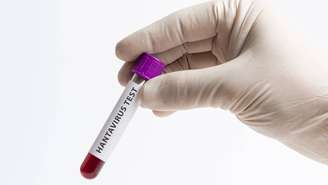 Esses sinais se confundem facilmente com influenza, dengue ou outras infecções virais frequentes. – depositphotos.com / julioricco