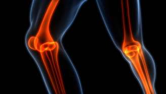 Classificada como um estágio intermediário entre a saúde óssea considerada normal e a osteoporose, a osteopenia não é inevitável, mas está ligada a fatores comuns do dia a dia, como sedentarismo, alimentação pobre em nutrientes e baixa exposição ao sol – depositphotos.com / magicmine