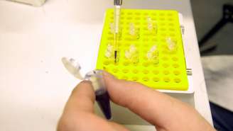 Instituição pesquisa meningococo em um laboratório