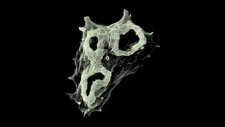 Naegleria fowleri, mais conhecida como a 'ameba comedora de cérebros', ataca o tecido cerebral