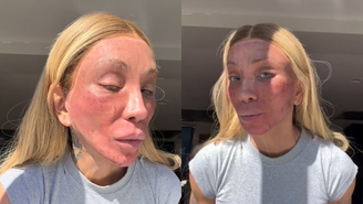 Maya Massafera mostra rosto após fazer peeling