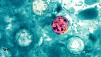 Parasita microscópico 'Cyclospora cayetanensis' provoca diarreia ‘explosiva’, que é aquosa e com evacuações frequentes