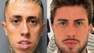 Antes e depois de MC Daniel