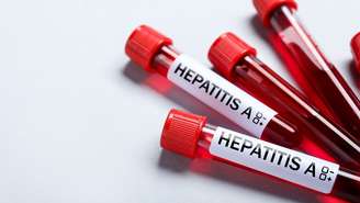 O Dia Mundial de Luta Contra as Hepatites Virais alerta para que agem sem dar sintomas no início e podem evoluir para complicações graves
