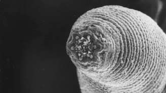 Esta imagem microscópica mostra a ponta afilada de um verme-do-diabo