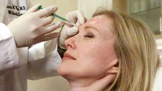 Cerca de 40% das injeções de botox e ácido hialurônico são realizadas de forma clandestina na França (imagem ilustrativa).