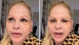 Monique Evans teve problemas com reconhecimento facial de banco após realizar cirurgia